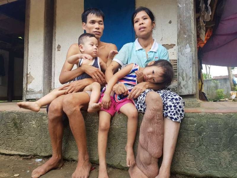 Hà Tĩnh: Cha mù lòa, mẹ bệnh nặng, hai đứa trẻ lả người vì đói
